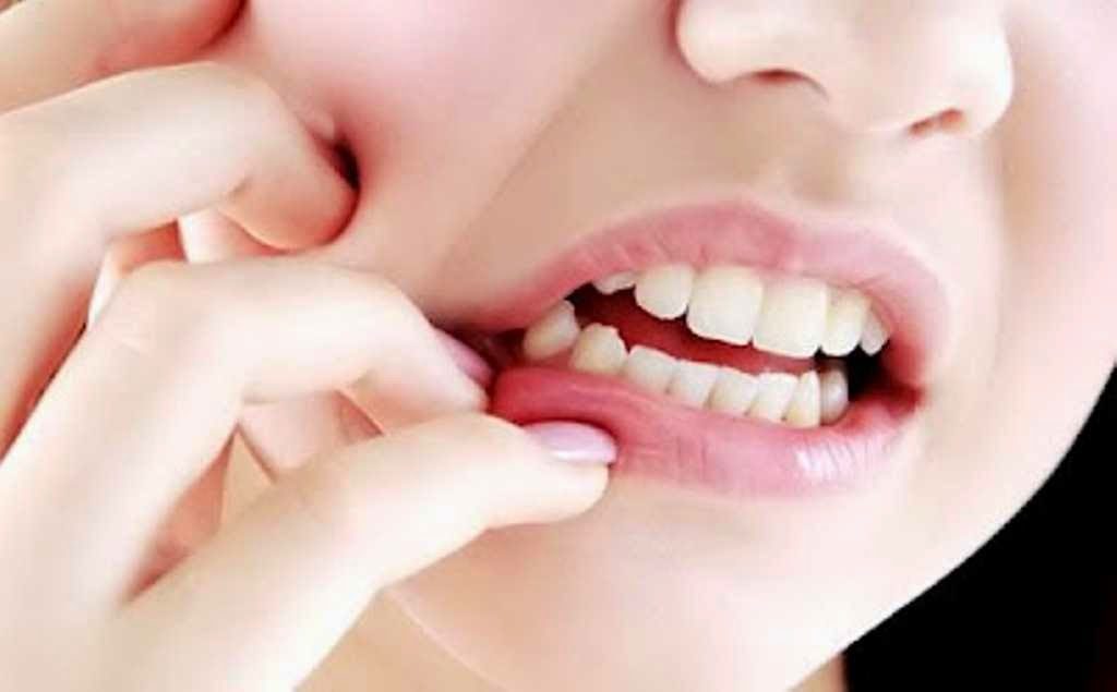 20 Petua Hilangkan Sakit Gigi Ketika Mengandung Tanpa Ubat ...
